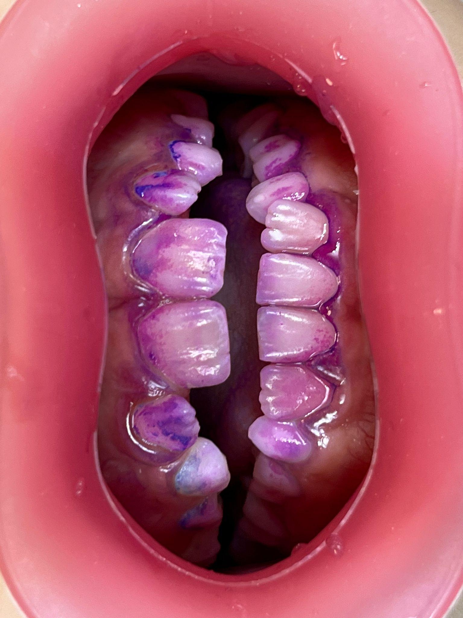Fotografia odontoiatrica intraorale: guida pratica per lo studio